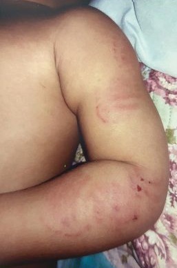 Após dois anos de agressão de bebê em creche particular de Boa Vista, mãe pede justiça