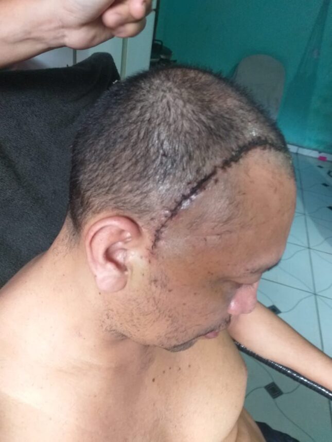 Paciente pede ajuda para conseguir fazer radioterapia em Manaus