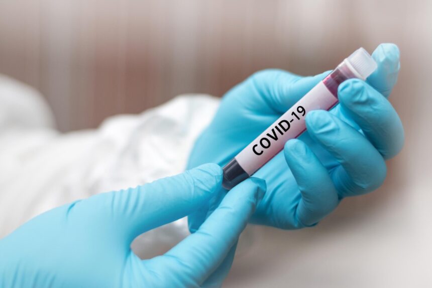 Covid-19: RR segue em zona de alerta na incidência da doença