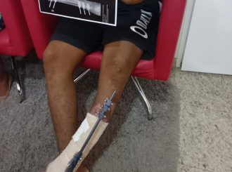 Governo não oferta cirurgia e Justiça bloqueia R$ 173 mil para paciente