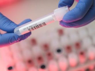 Casos de síndrome respiratória grave caem no país