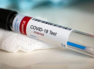 Roraima confirma seis novos casos de Covid-19