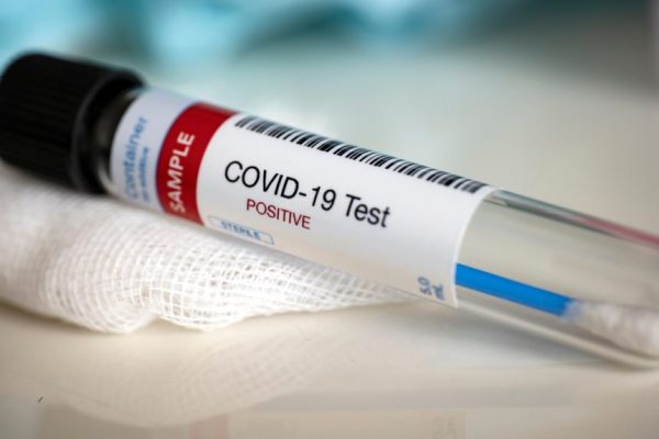 Roraima registra 6 novos casos de covid-19