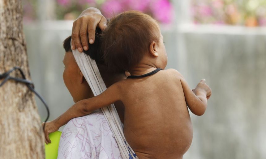Crianças Yanomami com quadro de desnutrição grave apresentam melhora