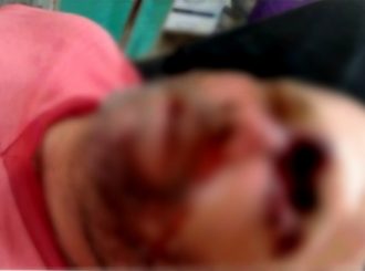 Homem leva tiro no olho em suposta tentativa de latrocínio
