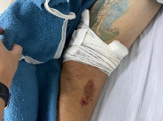 Denúncia afirma que paciente teve perna operada por engano no HGR