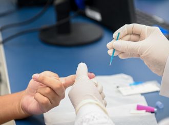 Unidades Básicas de Saúde de Boa Vista iniciaram testagem rápida para malária