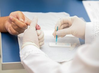 UBSs de Boa Vista iniciam testagem rápida para malária