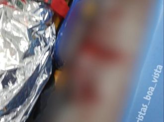 Jovem sofre fratura exposta ao invadir contramão e bater na lateral de ônibus em RR