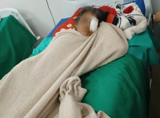Familiares de paciente que perdeu olho por tumor, denunciam demora para realização de cirurgia no HGR