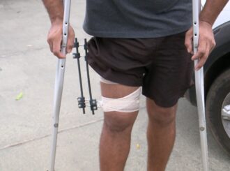 Homem é baleado na perna por PM à paisana após testemunhar agressão em RR; policial guardou cápsula da bala e fugiu do local