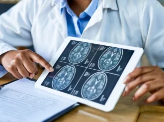 Implante no cérebro pode ajudar a tratar epilepsia e reduzir convulsões