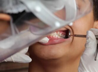 Brasil registra 43% de cobertura em saúde bucal; meta é alcançar 70%