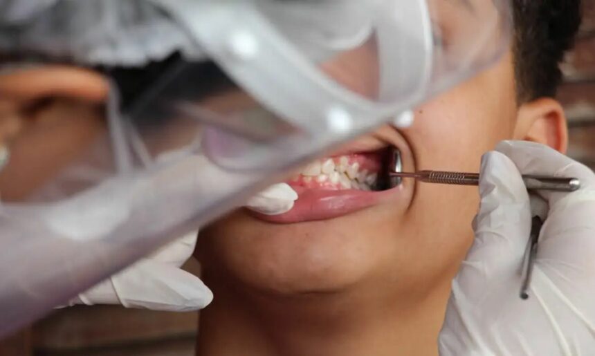 Brasil registra 43% de cobertura em saúde bucal; meta é alcançar 70%