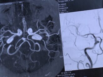 Com fortes dores de cabeça, paciente espera há três meses por consulta de retorno com neurologista no Coronel Mota