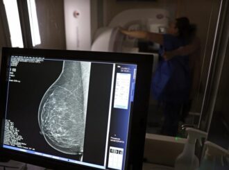 Ministério da Saúde passa a recomendar mamografia a partir dos 40 anos