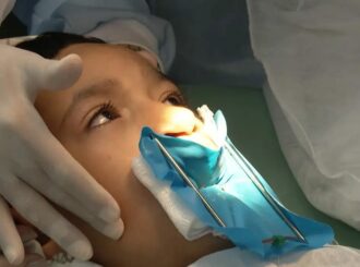 Sancionada lei que oferta cirurgia reconstrutiva de lábio leporino no SUS