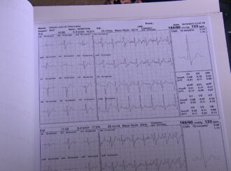 Paciente com Taquicardia denuncia a demora de dois anos no TFD para realização de cirurgia no coração