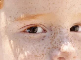 Reflexo branco nos olhos: entenda condição que assusta pais