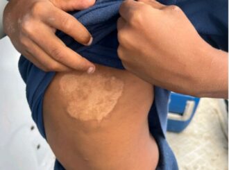 Polícia resgata crianças em situação de maus-tratos no Baixo Rio Branco