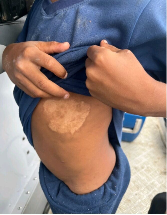 Polícia resgata crianças em situação de maus-tratos no Baixo Rio Branco