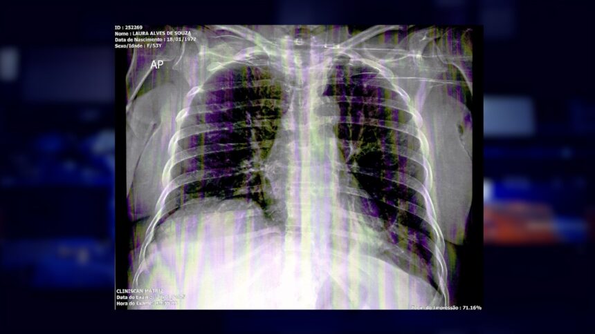 Paciente espera há oito meses por TFD para realizar cirurgia na coluna