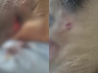 Idoso é esfaqueado pelo ex-genro em Boa Vista após defender filha de agressão