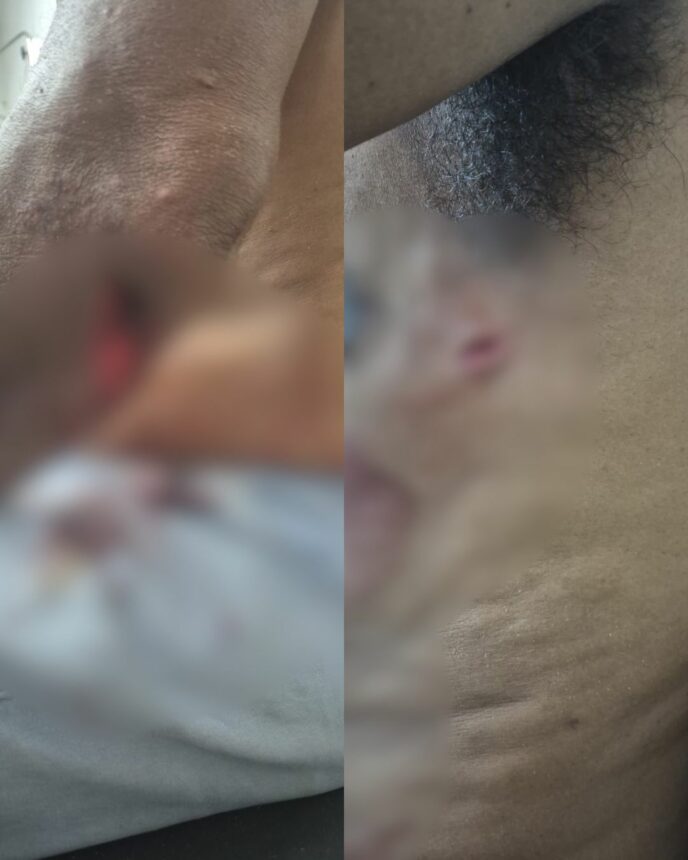 Idoso é esfaqueado pelo ex-genro em Boa Vista após defender filha de agressão