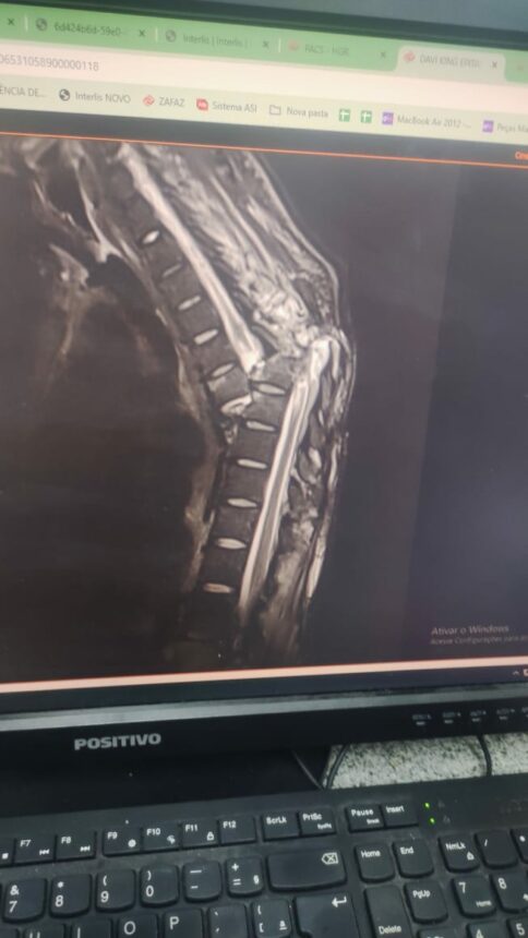 Jovem aguarda há mais de 50 dias por cirurgia; médicos alegam falta de material