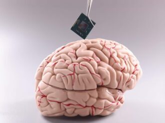 Implantes cerebrais: chips vão conectar cérebro a computadores