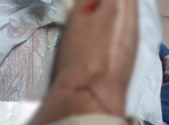 Mulher fica ferida após ser atacada com garrafa de vidro em casa shows no Caçari