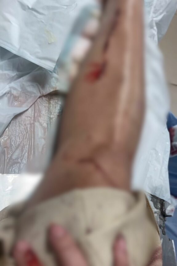 Mulher fica ferida após ser atacada com garrafa de vidro em casa shows no Caçari