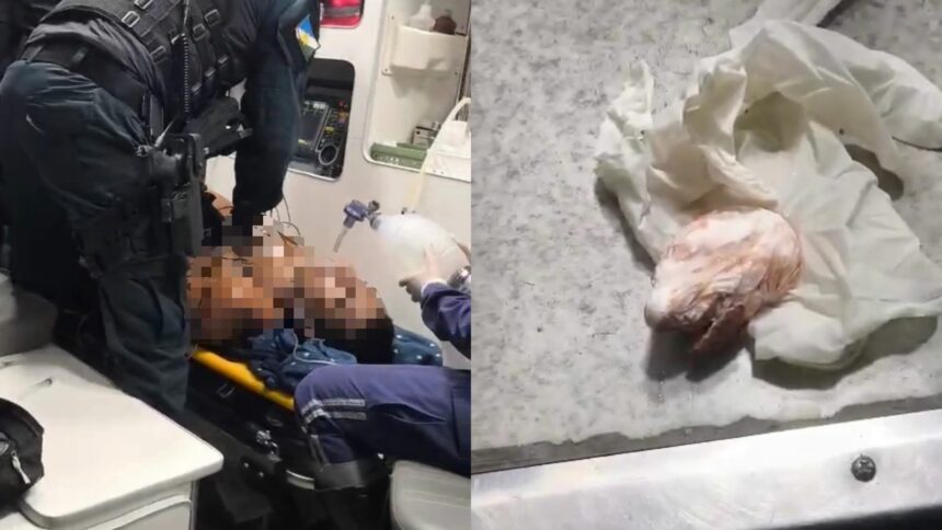 Policiais salvam homem que engoliu pacote de cocaína