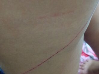 Homem atropela jovem após desentendimento em bar no interior de Roraima