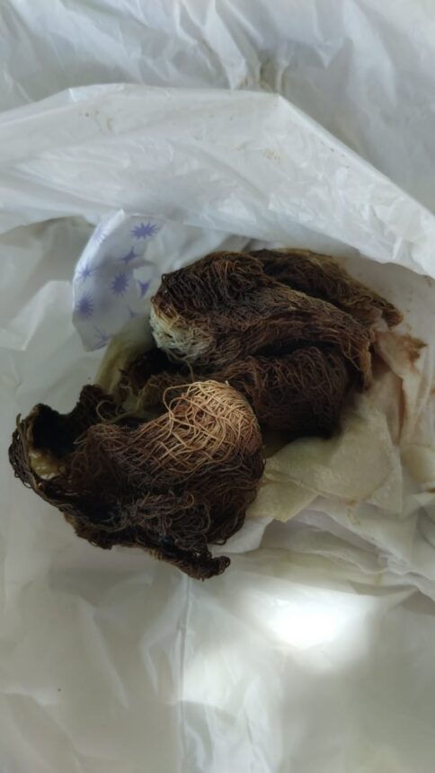 Gazes “apodrecidas” são encontradas dentro de mulher 10 dias após parto em Boa Vista, aponta denúncia