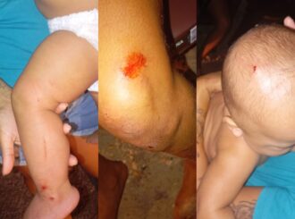 Ex-marido agride mulher e fere cabeça do filho de nove meses com cano de espingarda, no Sul de Roraima