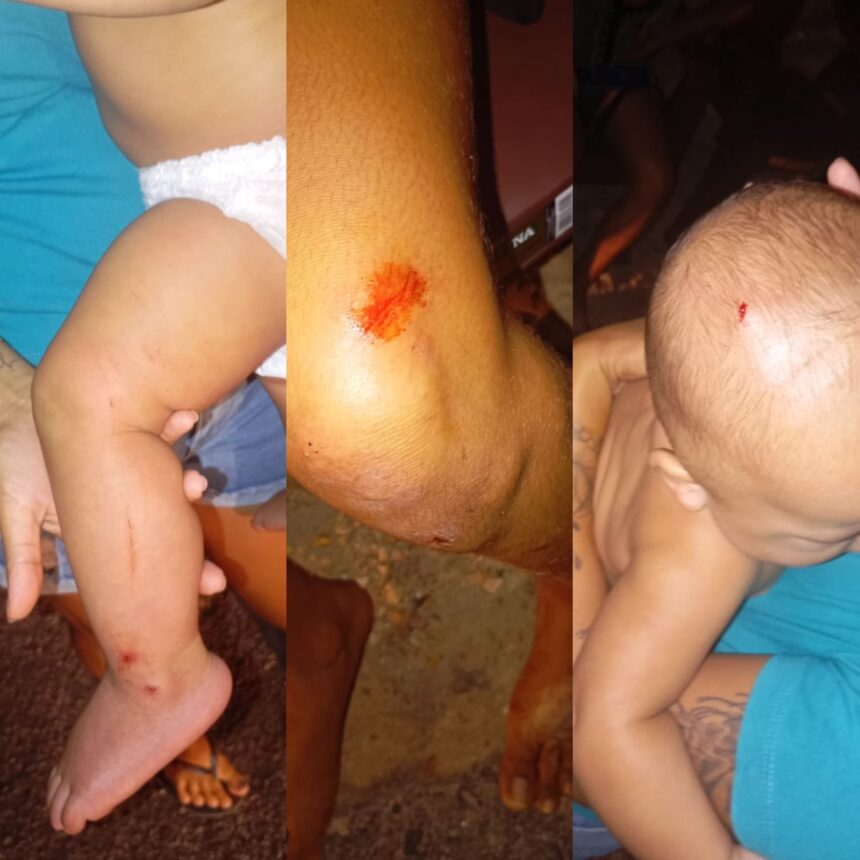 Ex-marido agride mulher e fere cabeça do filho de nove meses com cano de espingarda, no Sul de Roraima