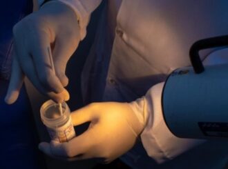 Senado: projeto busca ampliar rastreamento do câncer do colo do útero no SUS