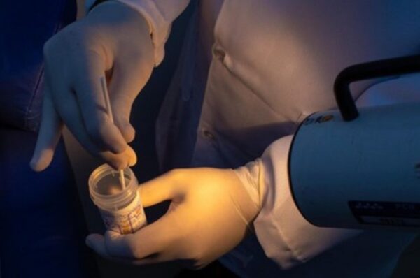 Senado: projeto busca ampliar rastreamento do câncer do colo do útero no SUS