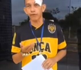 Vereador de Caracaraí agride repórter com soco após questionado sobre redutor de velocidade, diz denúncia