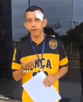 Vereador de Caracaraí agride repórter com soco após questionado sobre redutor de velocidade, diz denúncia