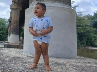 Mãe promove ‘pix solidário’ para custear peça ortopédica do filho com deformidade nos joelhos; meta é arrecadar R$ 1,4 mil