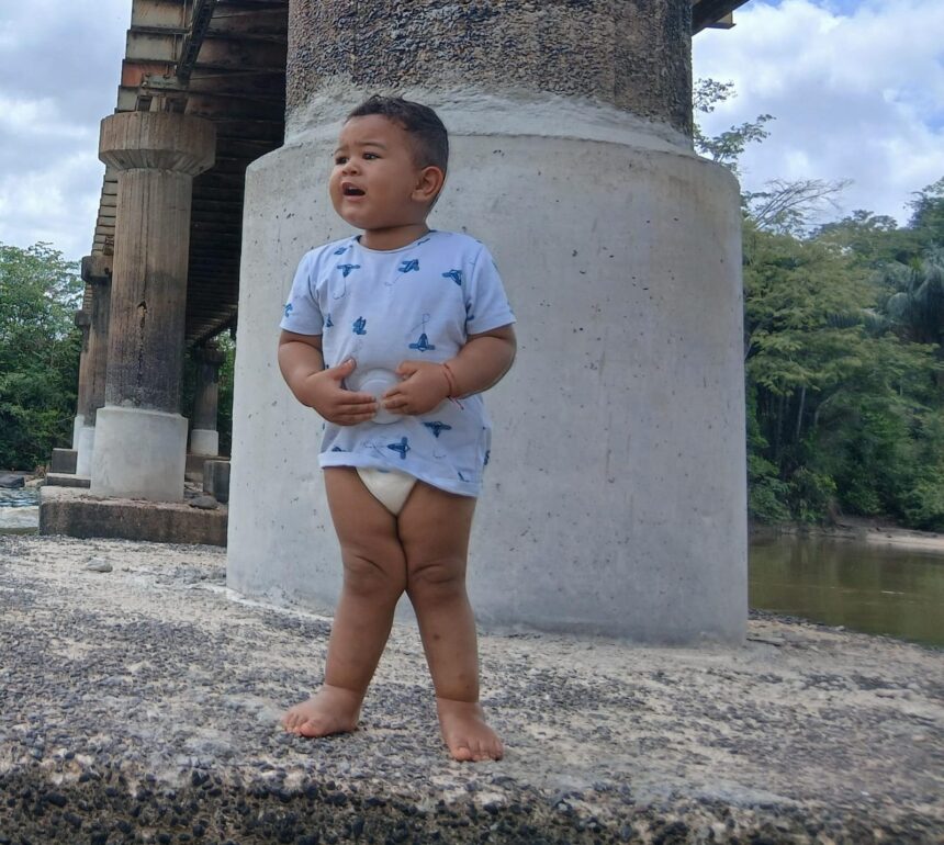 Mãe promove ‘pix solidário’ para custear peça ortopédica do filho com deformidade nos joelhos; meta é arrecadar R$ 1,4 mil