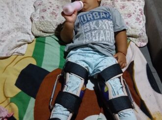 Após ‘pix solidário’ criança com deformidade nos joelhos consegue custear peça ortopédica
