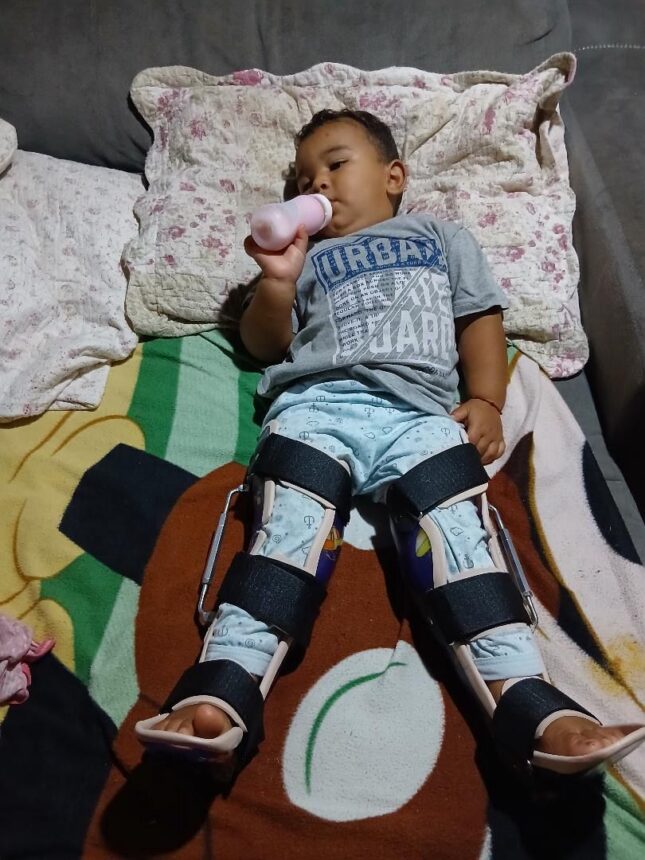 Após ‘pix solidário’ criança com deformidade nos joelhos consegue custear peça ortopédica