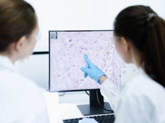 Anvisa aprova novo medicamento para linfoma não Hodgkin