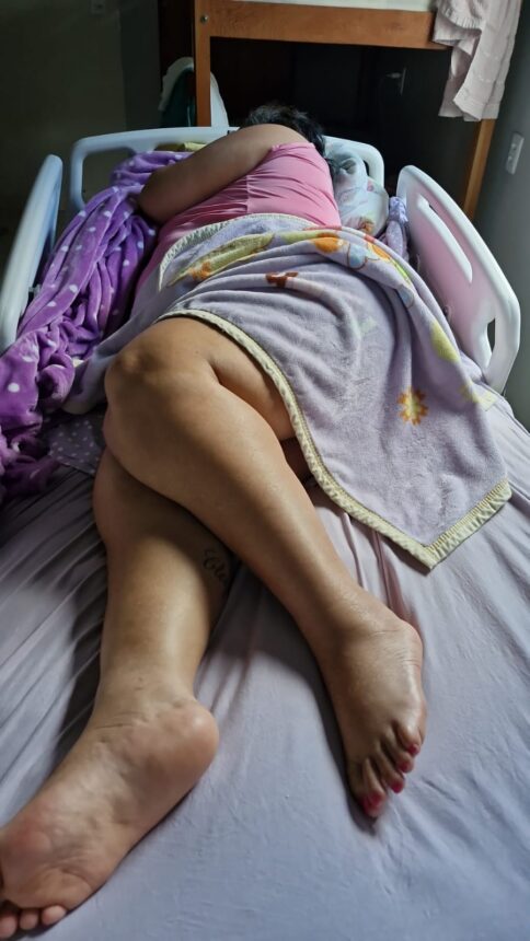 Paciente paraplégica denuncia demora de dois anos para conseguir cirurgia de artrodese na coluna no HGR