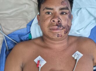 HGR solicita comparecimento de familiares de paciente venezuelano internado na UTI