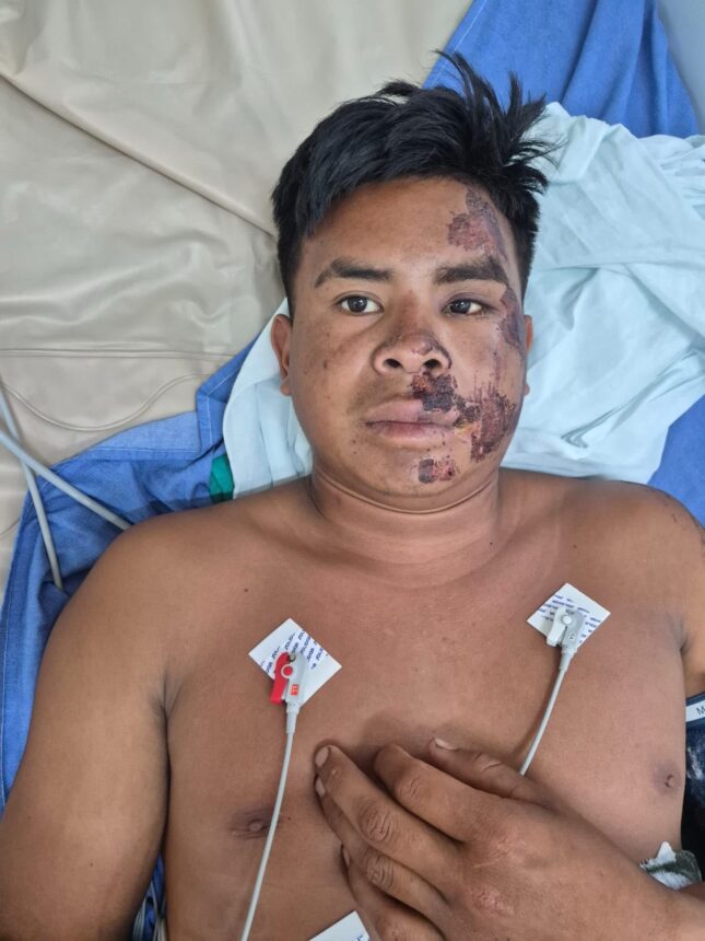 HGR solicita comparecimento de familiares de paciente venezuelano internado na UTI