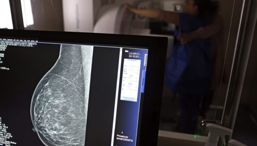 Casos e mortes por câncer de mama podem aumentar em 40% até 2050, alerta OMS
